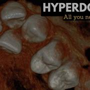 Hyperdontia