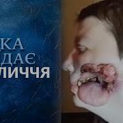Дыра Съедает Мое Лицо Полный Выпуск Говорить Україна