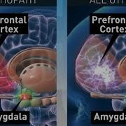 Lowerzone Psycopath