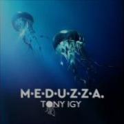 Tony Igy M E D U Z Z A Remix