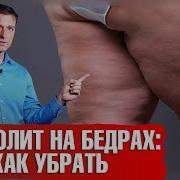 Milfфото Голые Жирные Целлюлитные Ляжки