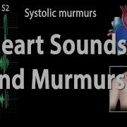 Murmus