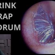 Ear Drum