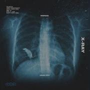 X Ray Monzaa Jenia