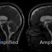 Brain Scan