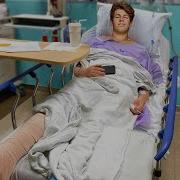 I Broke My Leg