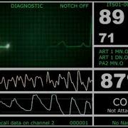 Hospital Monitor With Flatline L Hd Pandemicarchive